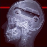 Unser Auto